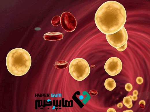 چگونه می توان چربی خون را بدون دارو درمان کرد؟!